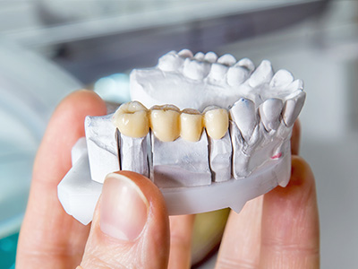 A person s hand holding a 3D printed model of a human mouth with teeth and gums.