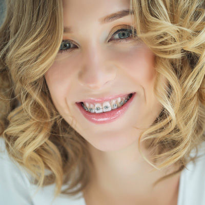 A woman with a smile, wearing braces and a white top, against a light background.