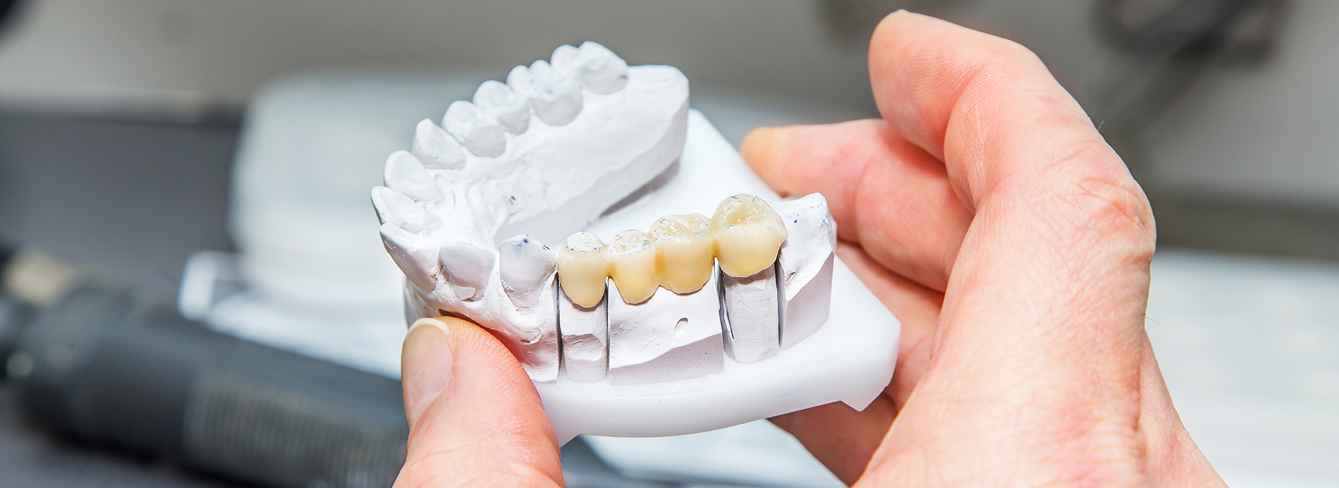 The image shows a person holding a dental model with multiple teeth, likely for educational or demonstration purposes.